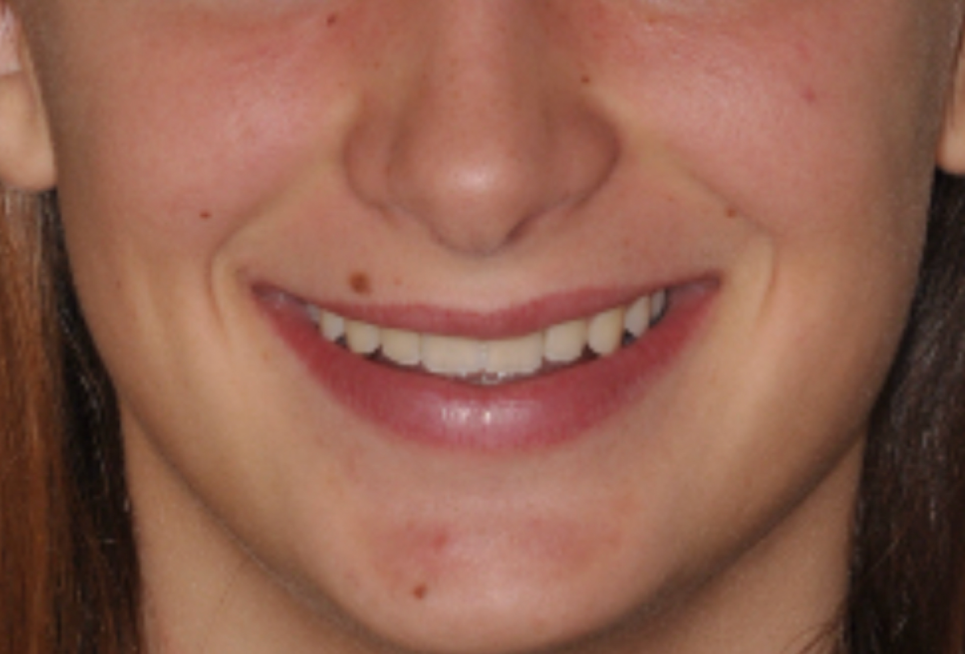 il sorriso di Beatrice dopo