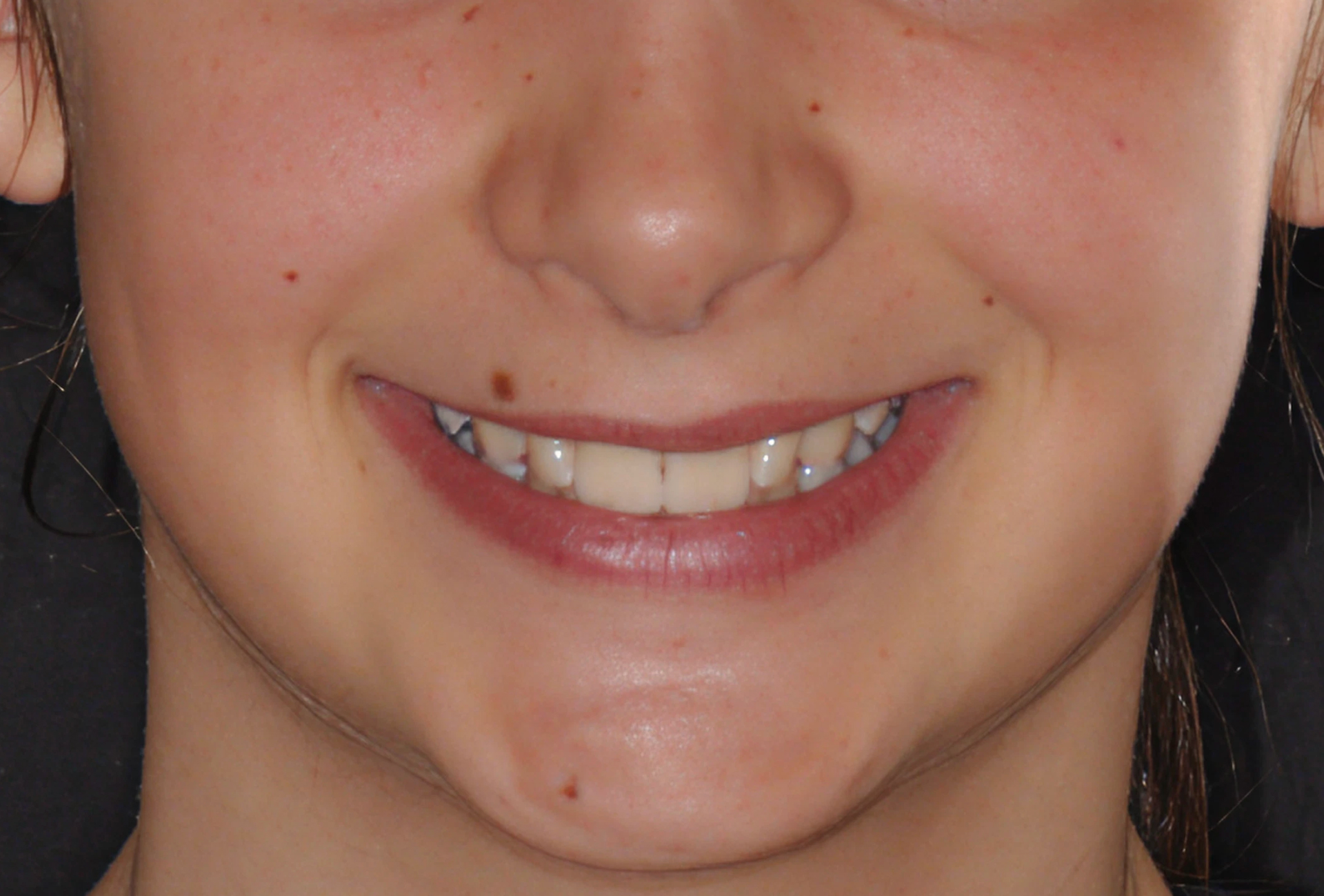 il sorriso di alina Beatrice