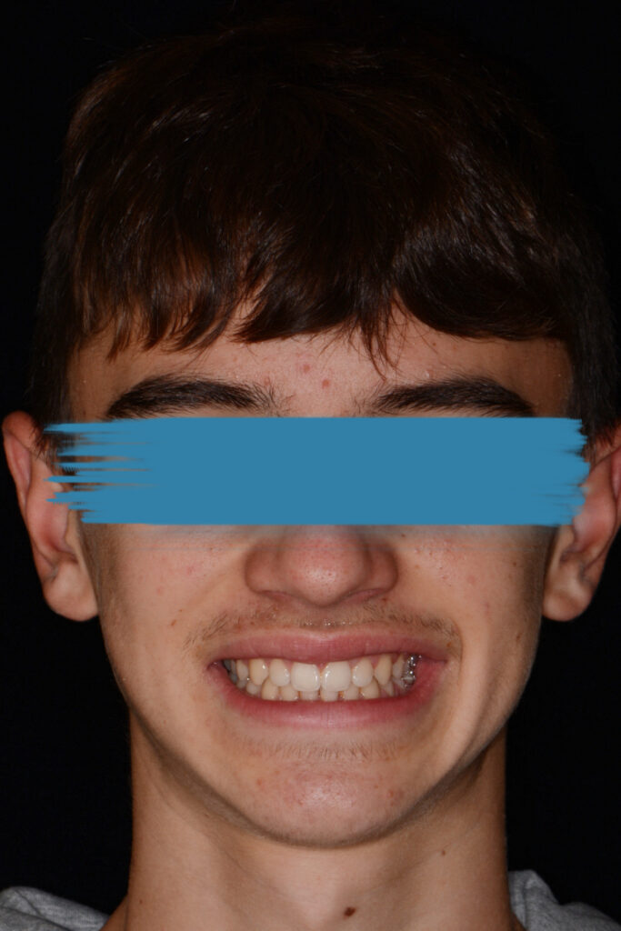 il sorriso di Filippo