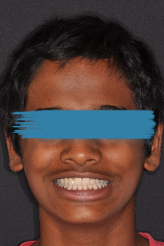 il sorriso di Zayan
