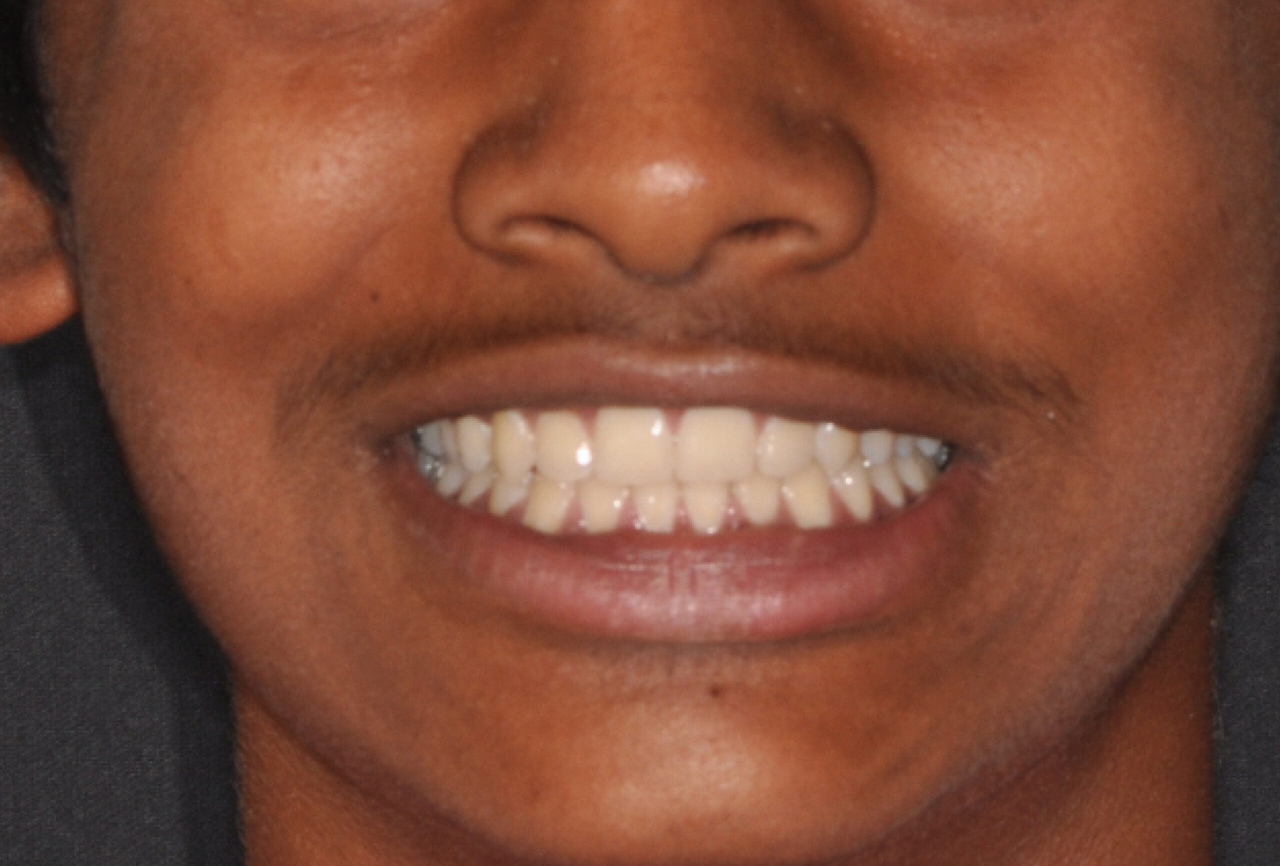 il sorriso di Zayan dopo