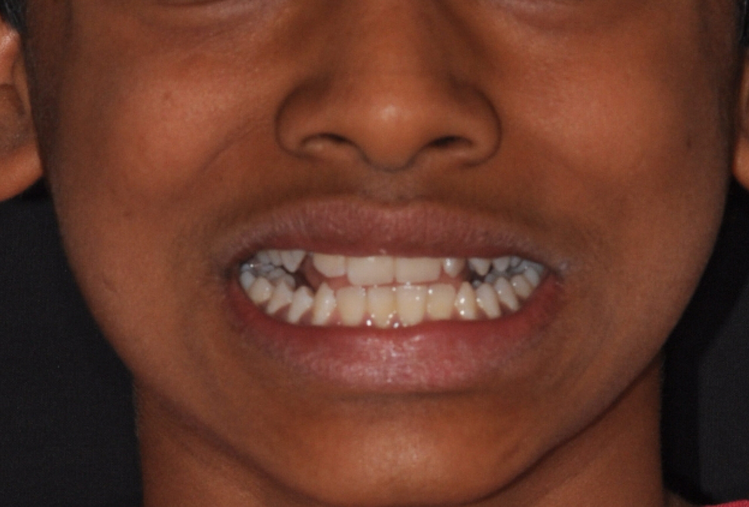 il sorriso di Zayan prima